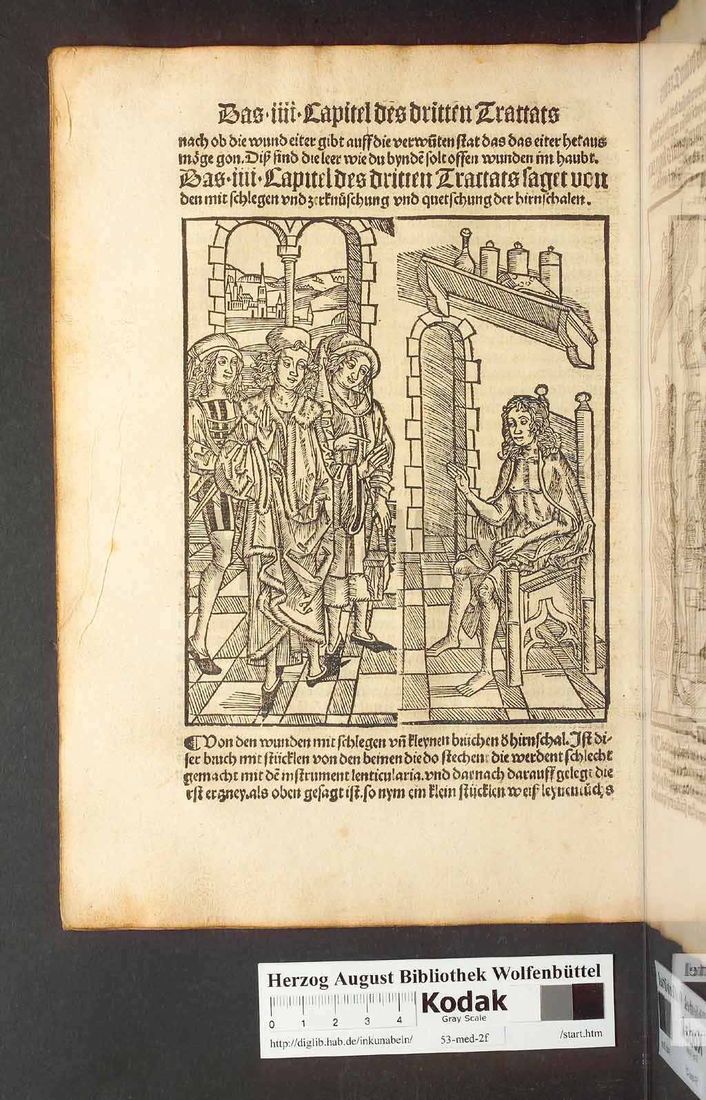 http://diglib.hab.de/inkunabeln/53-med-2f/00096.jpg