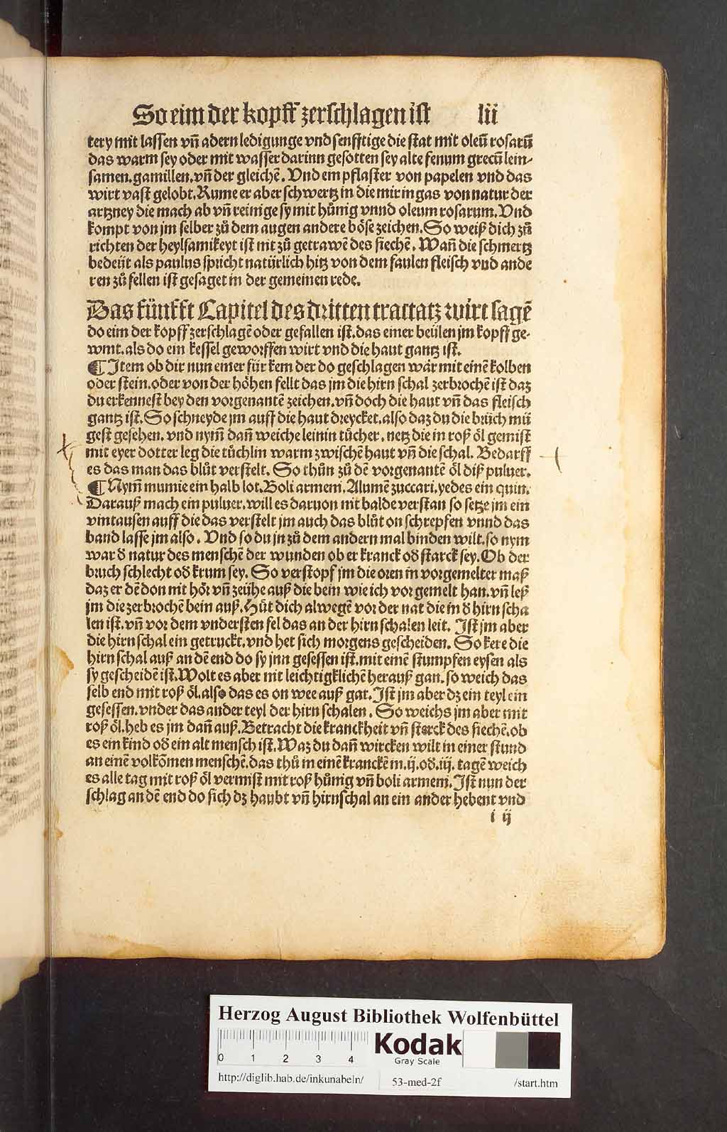 http://diglib.hab.de/inkunabeln/53-med-2f/00101.jpg