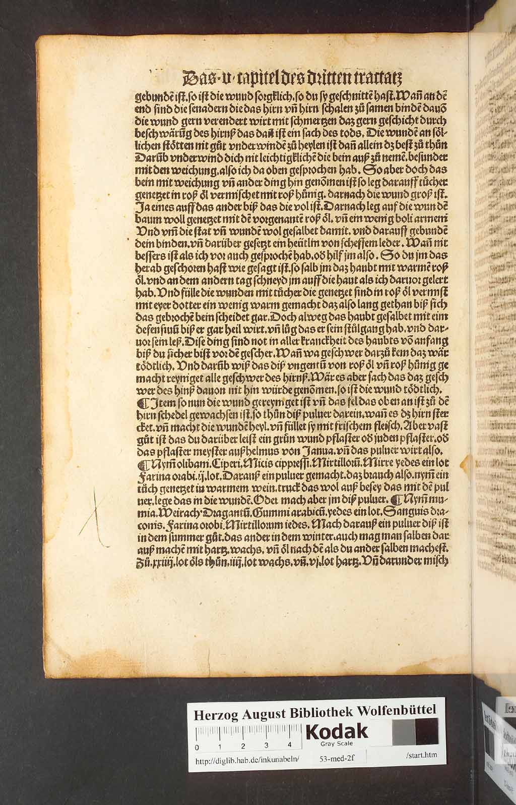 http://diglib.hab.de/inkunabeln/53-med-2f/00102.jpg