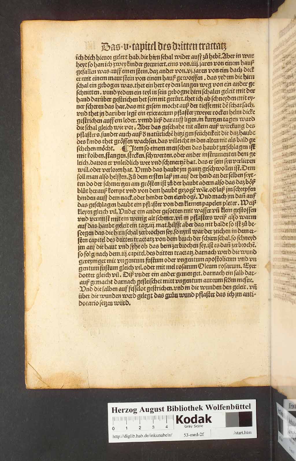 http://diglib.hab.de/inkunabeln/53-med-2f/00104.jpg