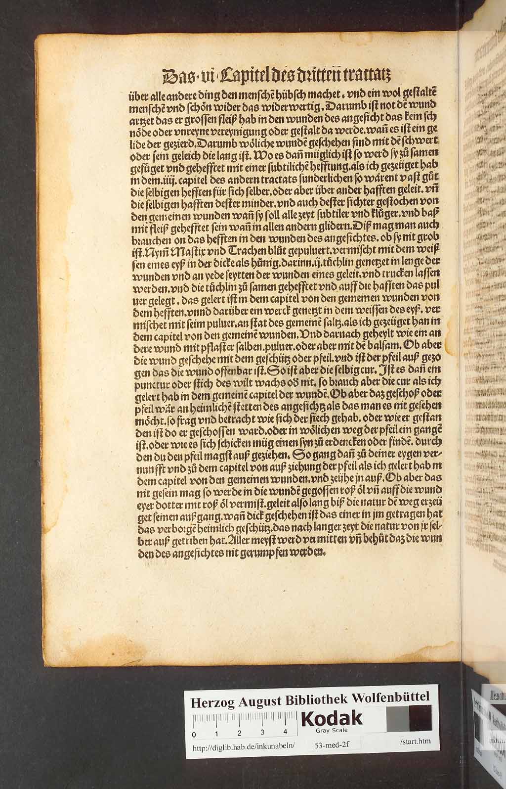 http://diglib.hab.de/inkunabeln/53-med-2f/00106.jpg