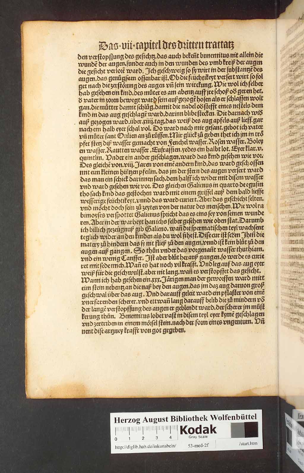 http://diglib.hab.de/inkunabeln/53-med-2f/00108.jpg