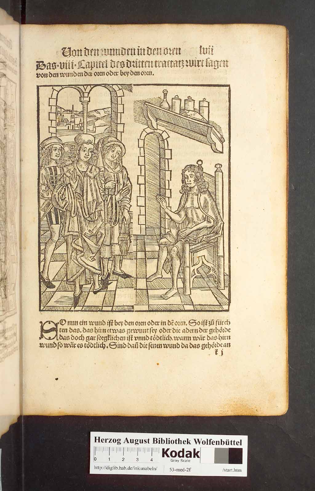 http://diglib.hab.de/inkunabeln/53-med-2f/00111.jpg