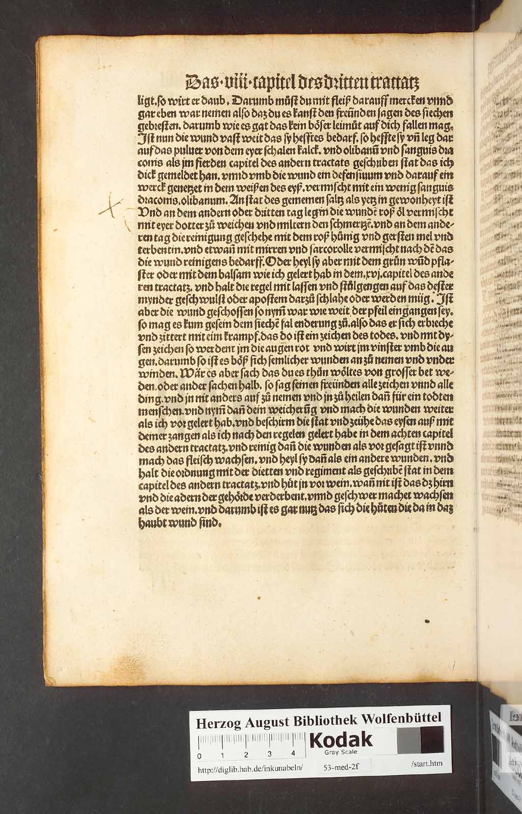 http://diglib.hab.de/inkunabeln/53-med-2f/00112.jpg