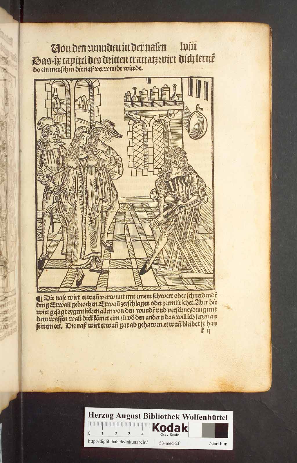 http://diglib.hab.de/inkunabeln/53-med-2f/00113.jpg