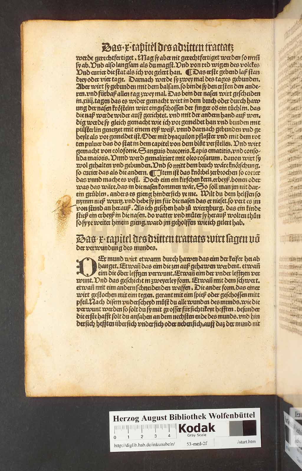http://diglib.hab.de/inkunabeln/53-med-2f/00116.jpg