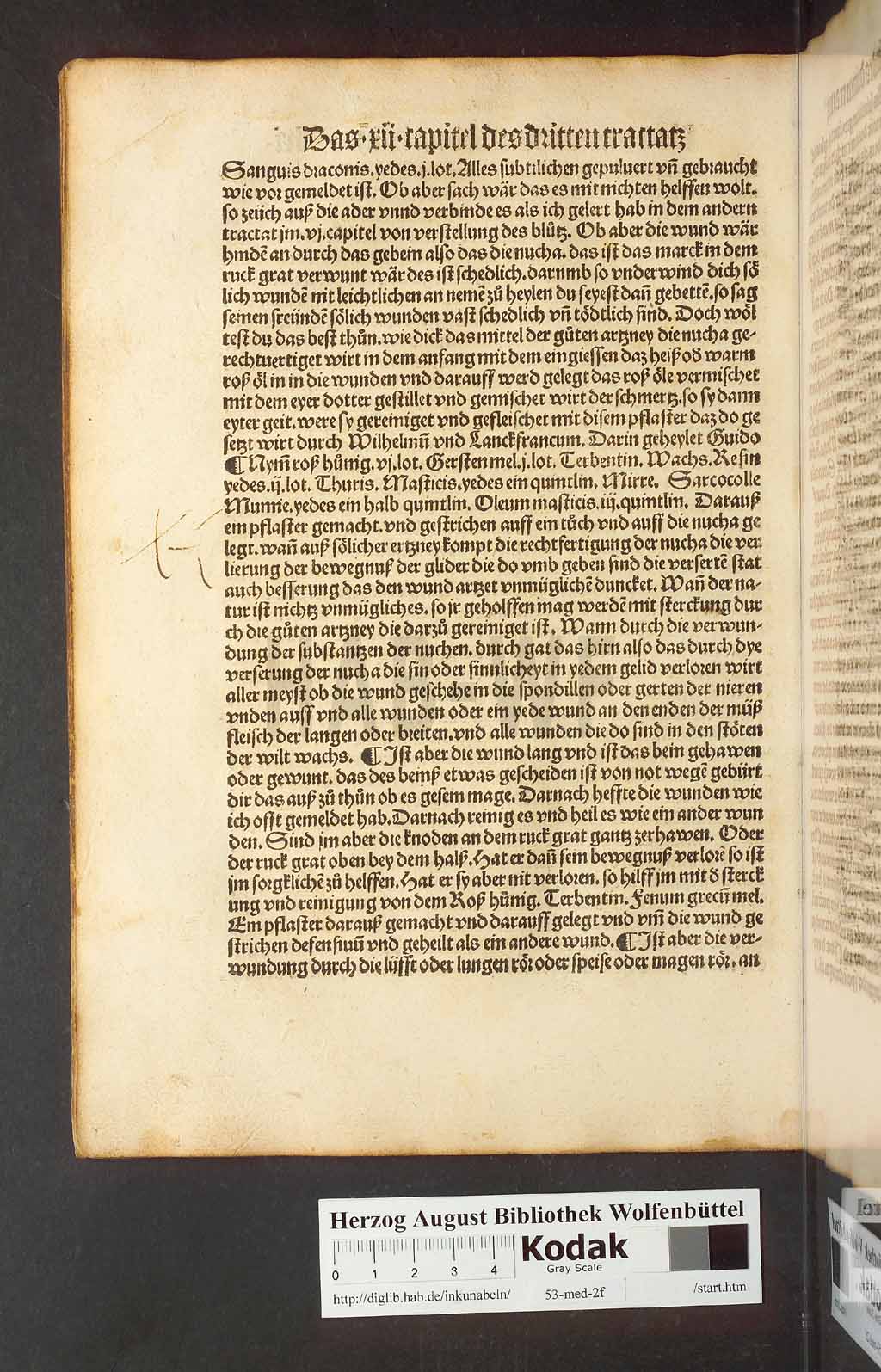 http://diglib.hab.de/inkunabeln/53-med-2f/00120.jpg