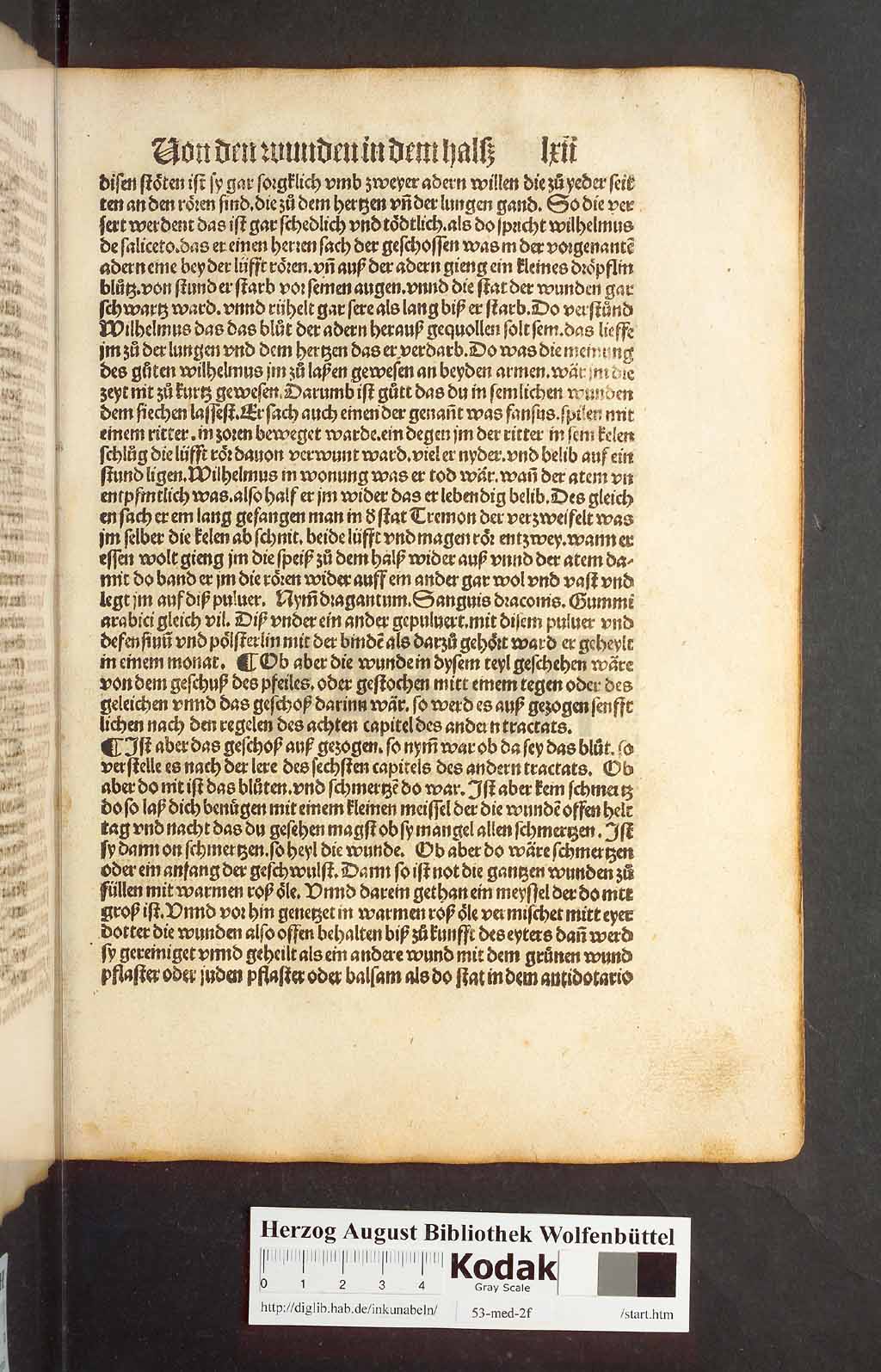 http://diglib.hab.de/inkunabeln/53-med-2f/00121.jpg