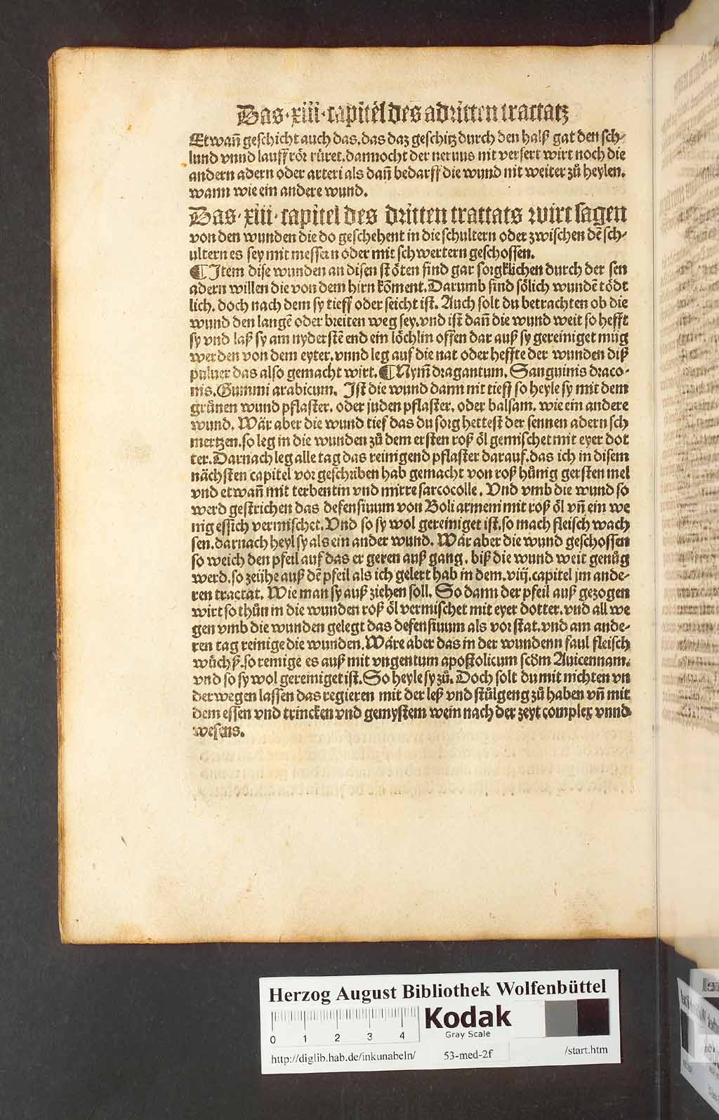 http://diglib.hab.de/inkunabeln/53-med-2f/00122.jpg