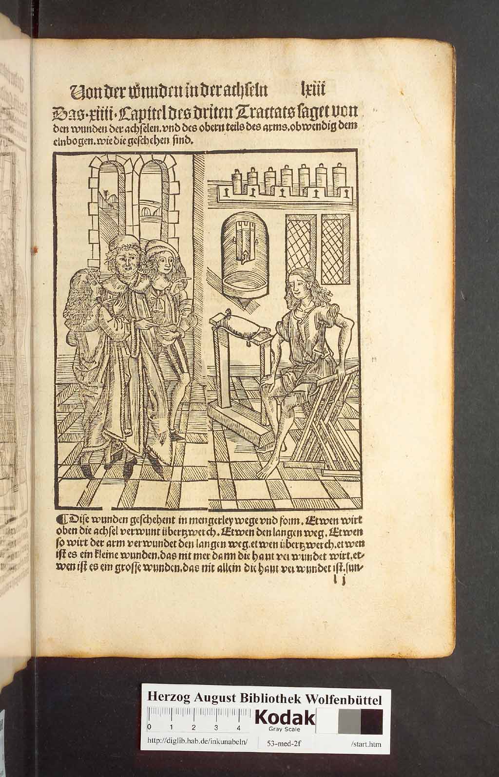 http://diglib.hab.de/inkunabeln/53-med-2f/00123.jpg