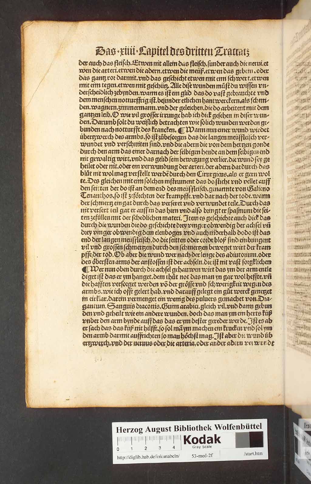 http://diglib.hab.de/inkunabeln/53-med-2f/00124.jpg