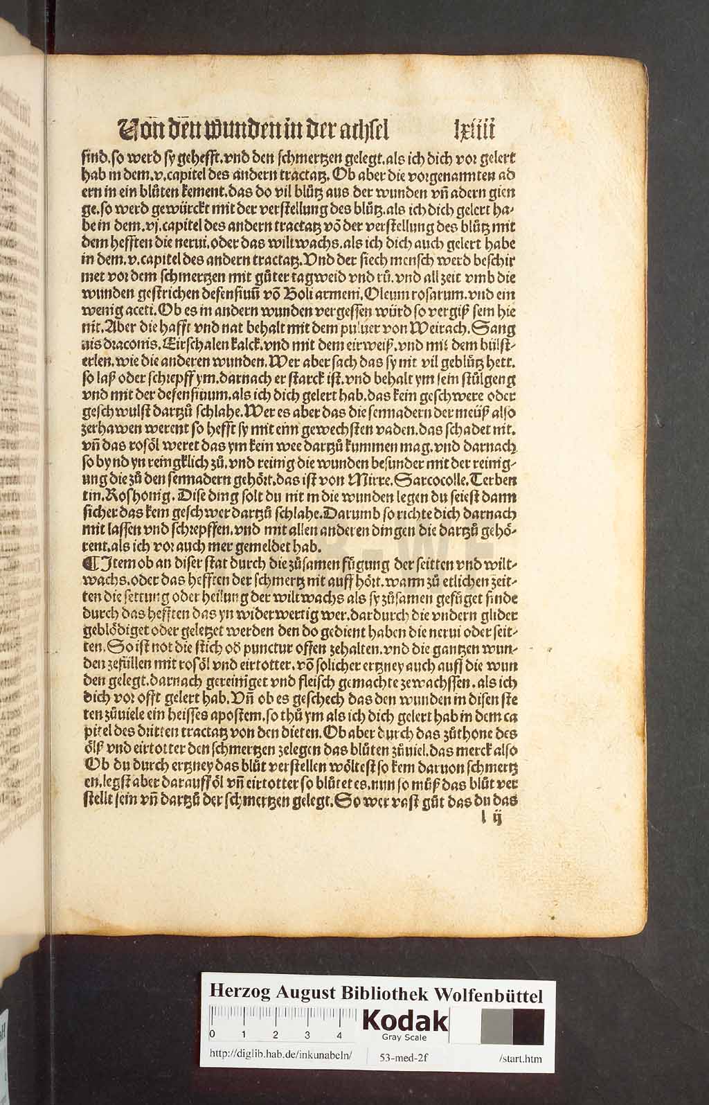 http://diglib.hab.de/inkunabeln/53-med-2f/00125.jpg