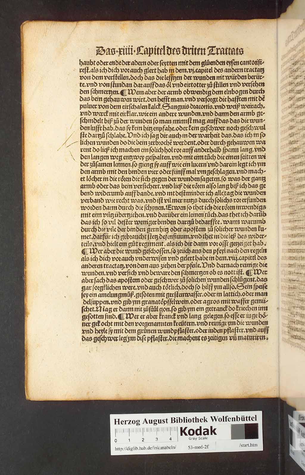 http://diglib.hab.de/inkunabeln/53-med-2f/00126.jpg