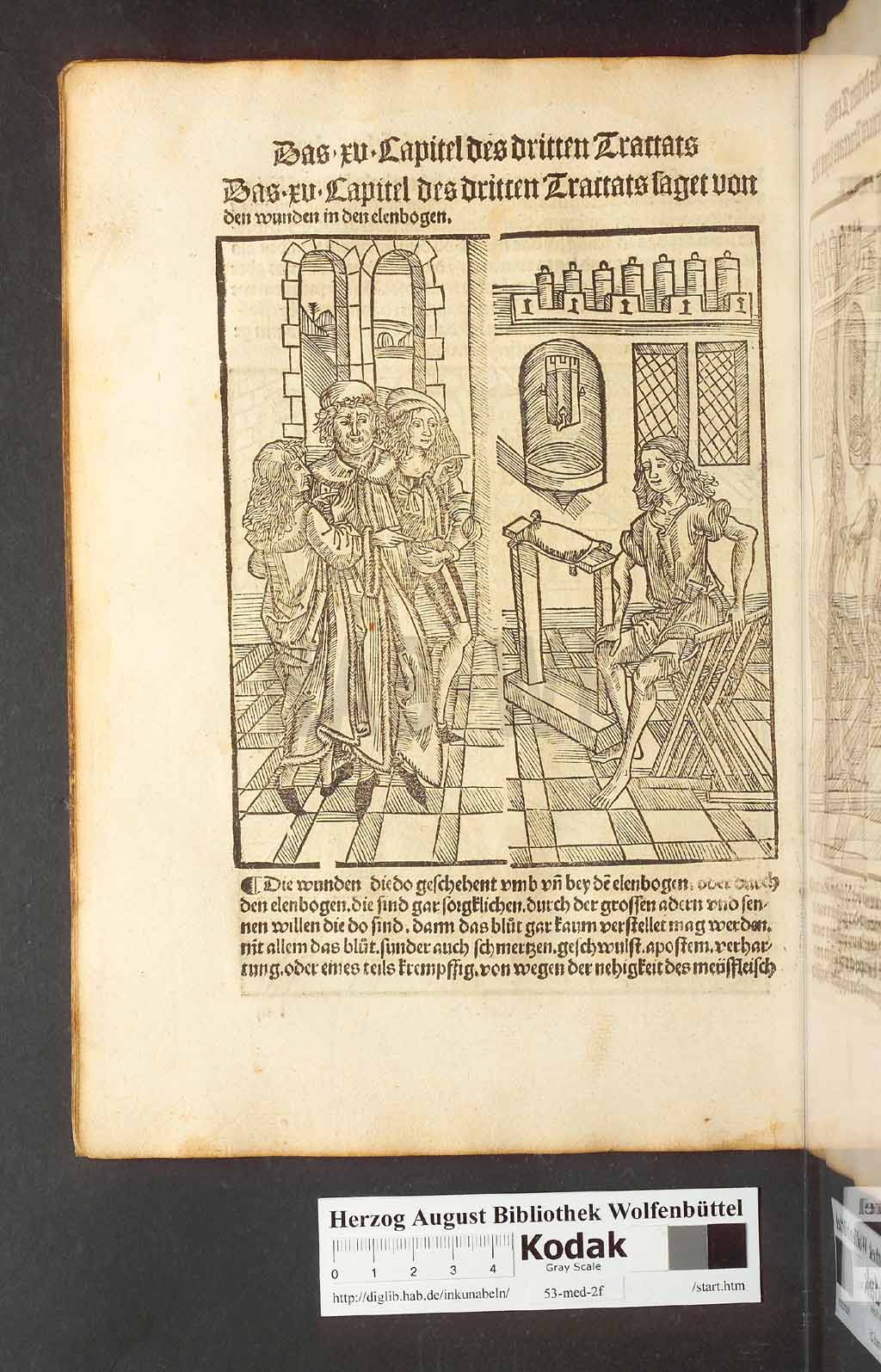 http://diglib.hab.de/inkunabeln/53-med-2f/00128.jpg