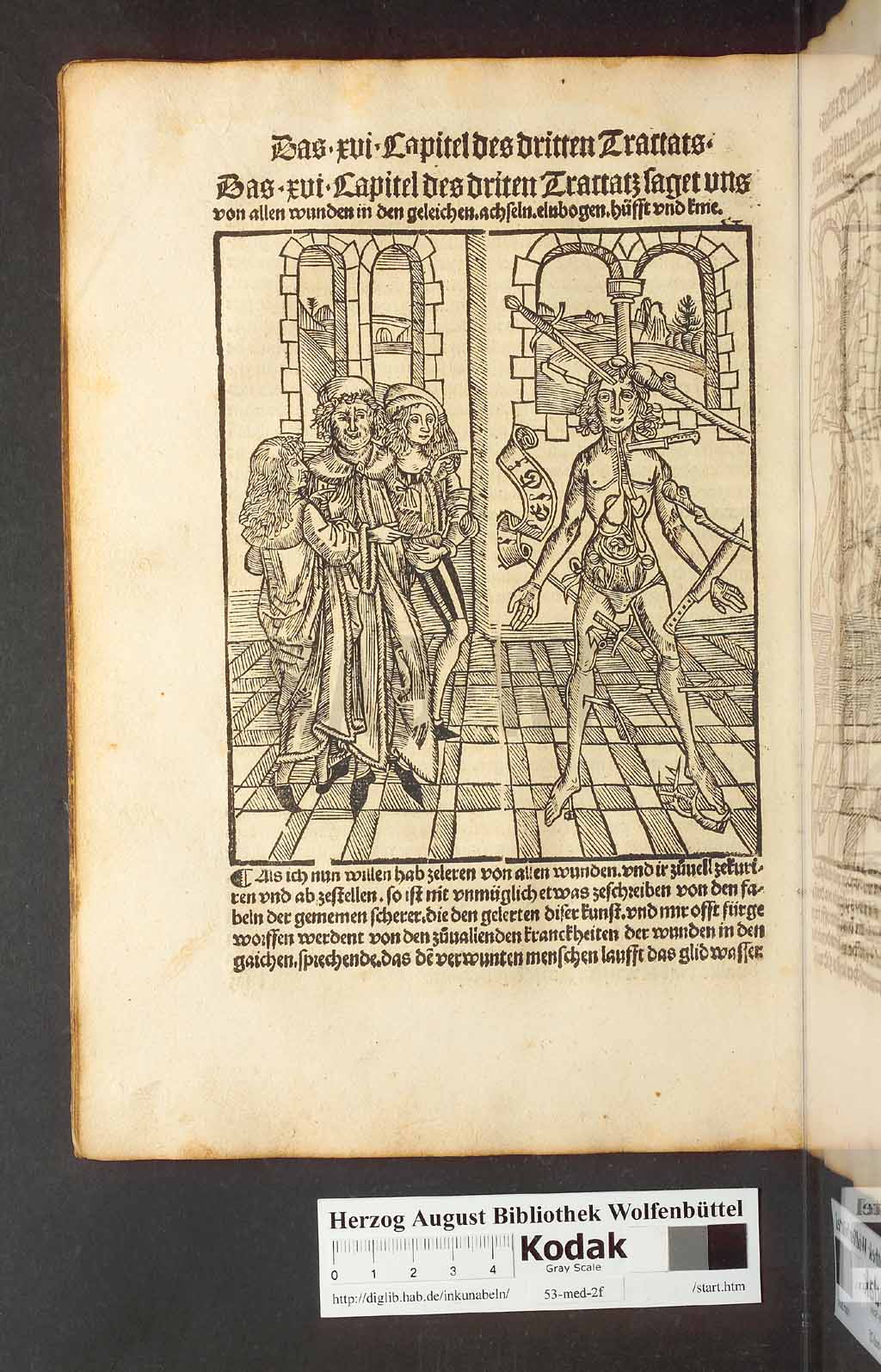 http://diglib.hab.de/inkunabeln/53-med-2f/00130.jpg