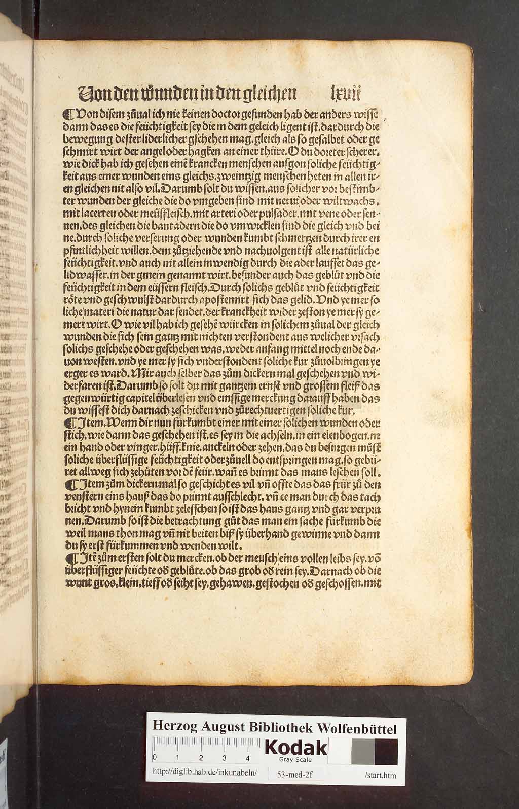 http://diglib.hab.de/inkunabeln/53-med-2f/00131.jpg