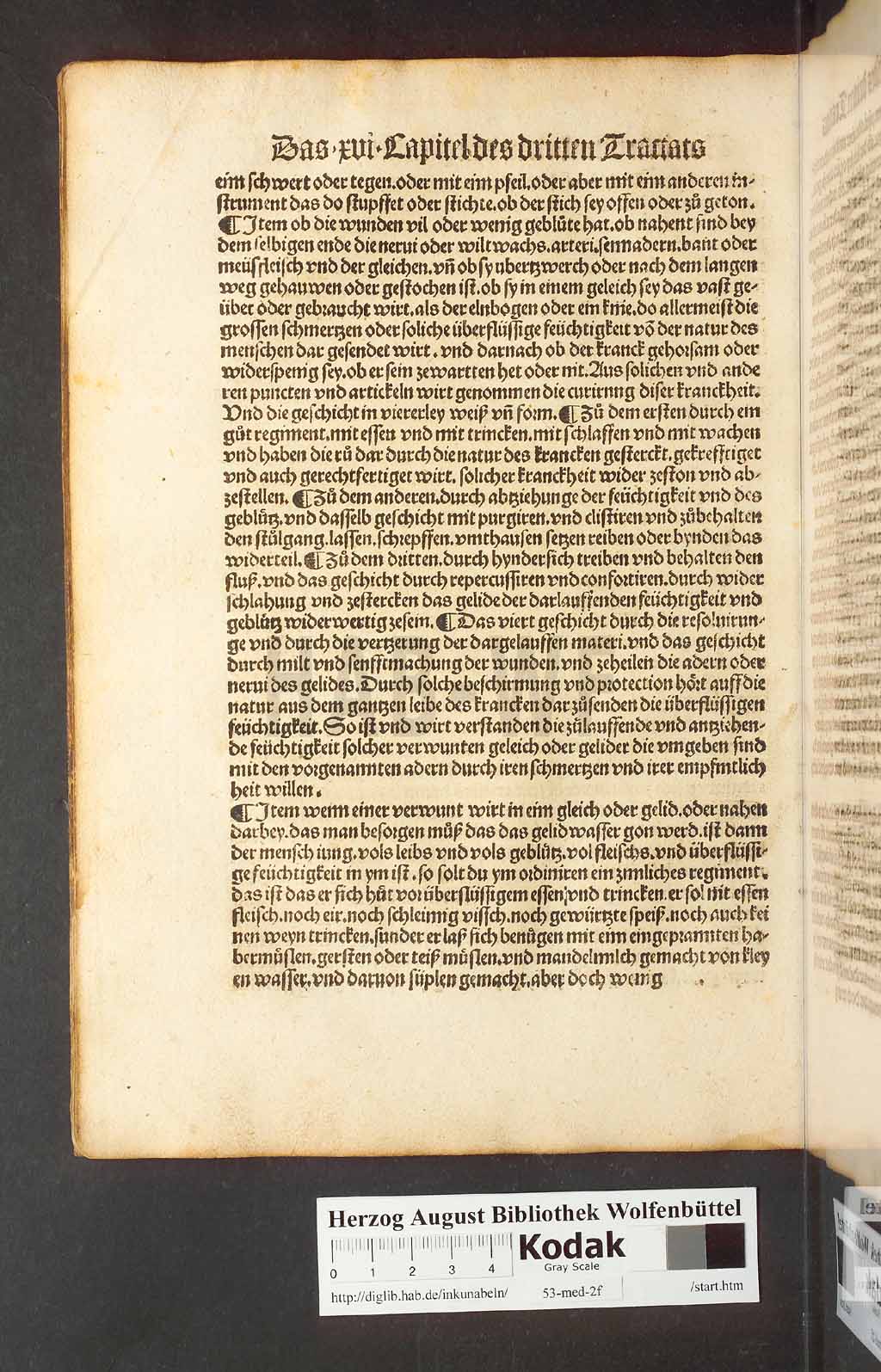 http://diglib.hab.de/inkunabeln/53-med-2f/00132.jpg