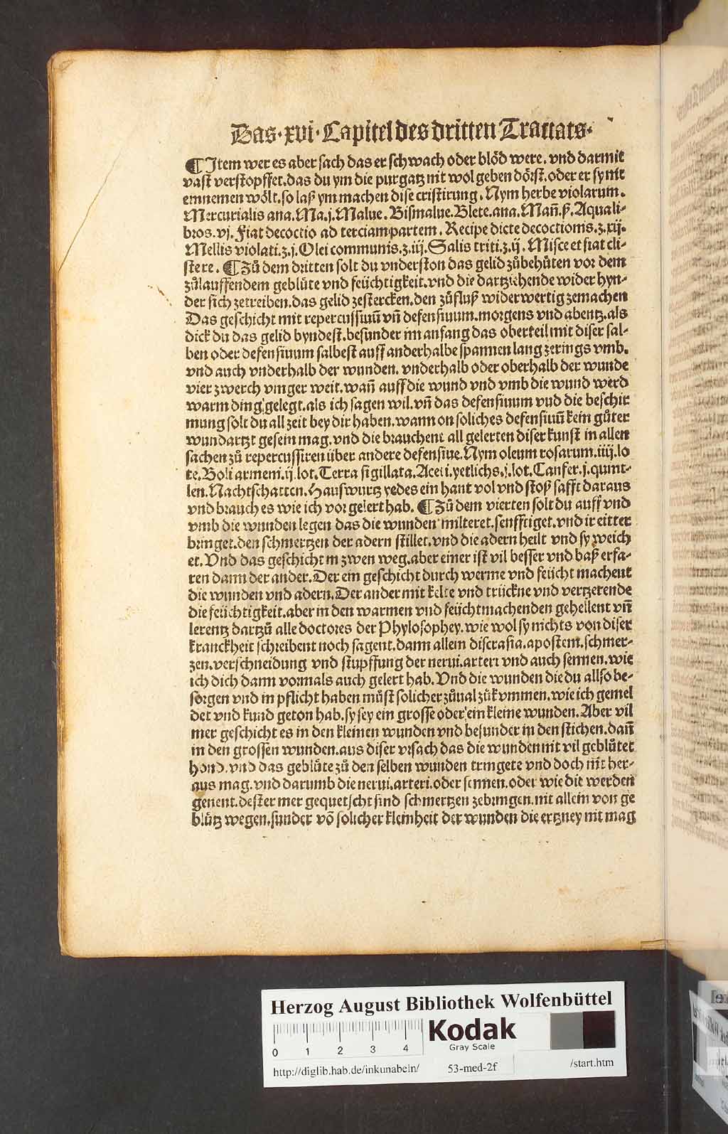 http://diglib.hab.de/inkunabeln/53-med-2f/00134.jpg