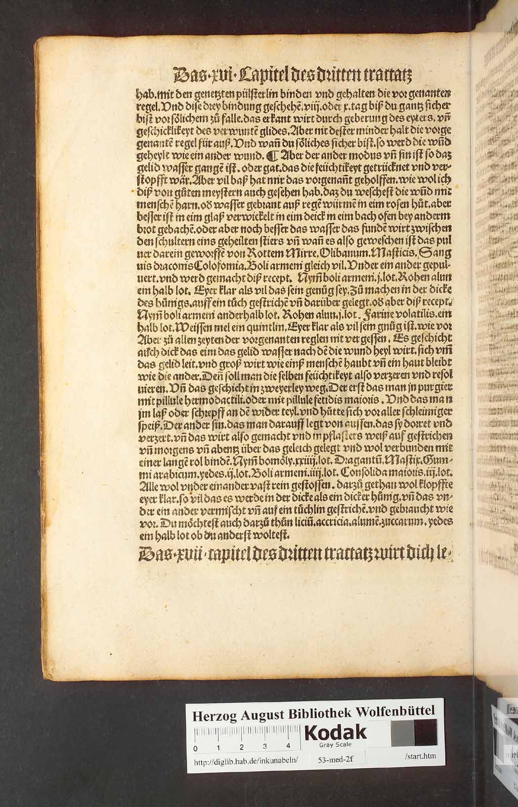 http://diglib.hab.de/inkunabeln/53-med-2f/00136.jpg