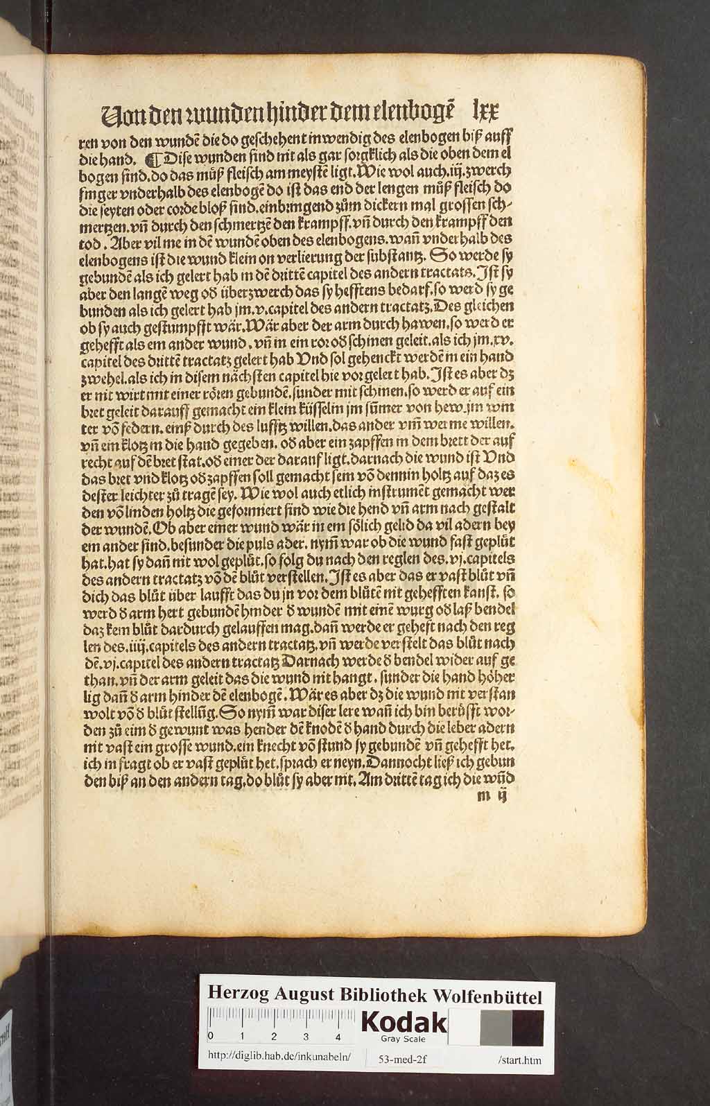 http://diglib.hab.de/inkunabeln/53-med-2f/00137.jpg
