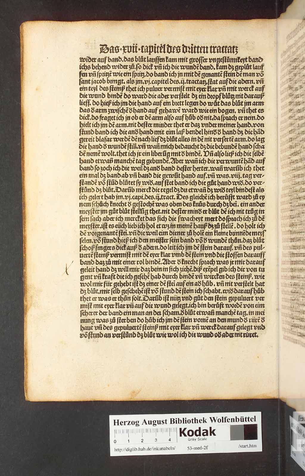 http://diglib.hab.de/inkunabeln/53-med-2f/00138.jpg
