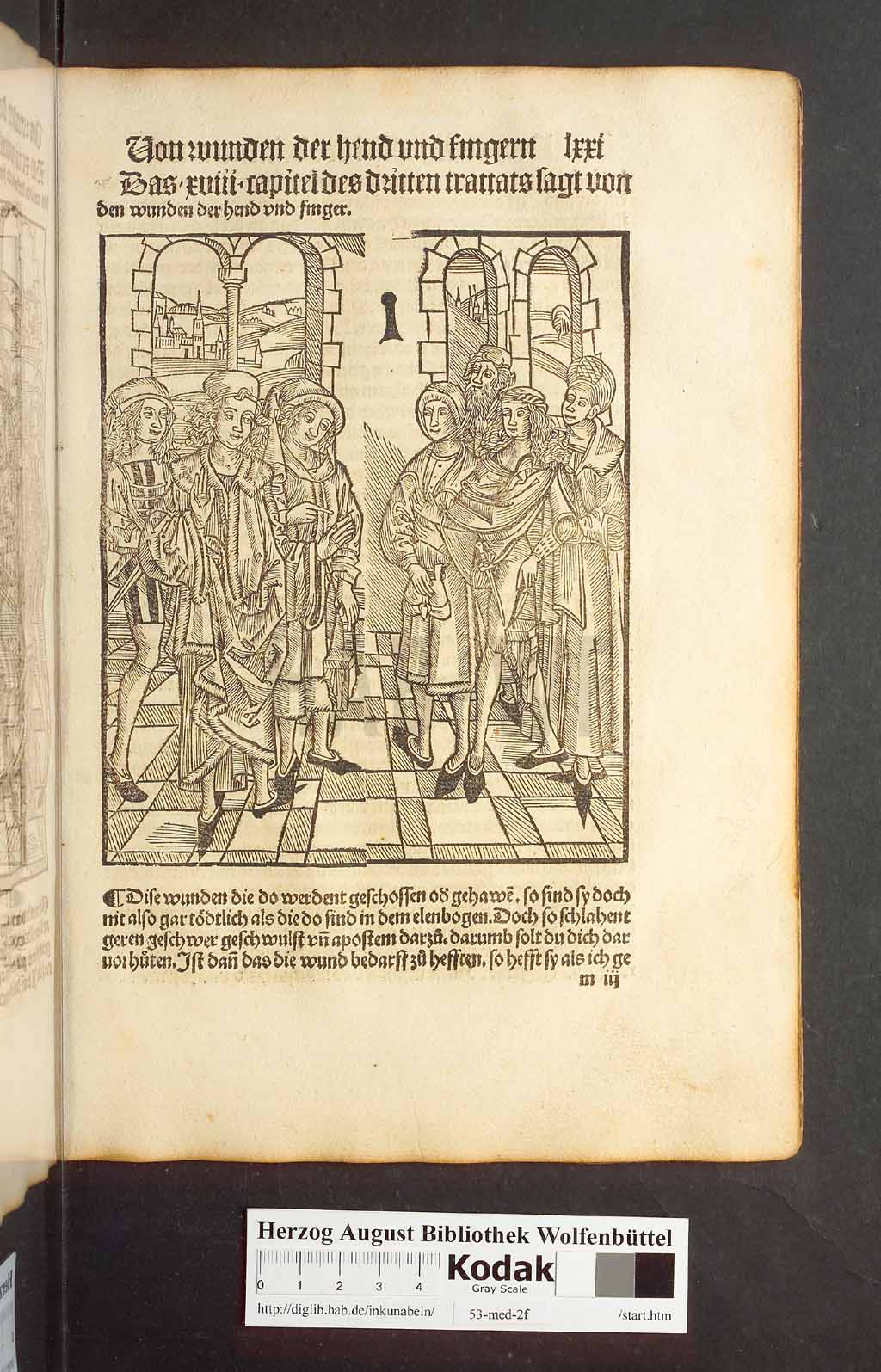 http://diglib.hab.de/inkunabeln/53-med-2f/00139.jpg