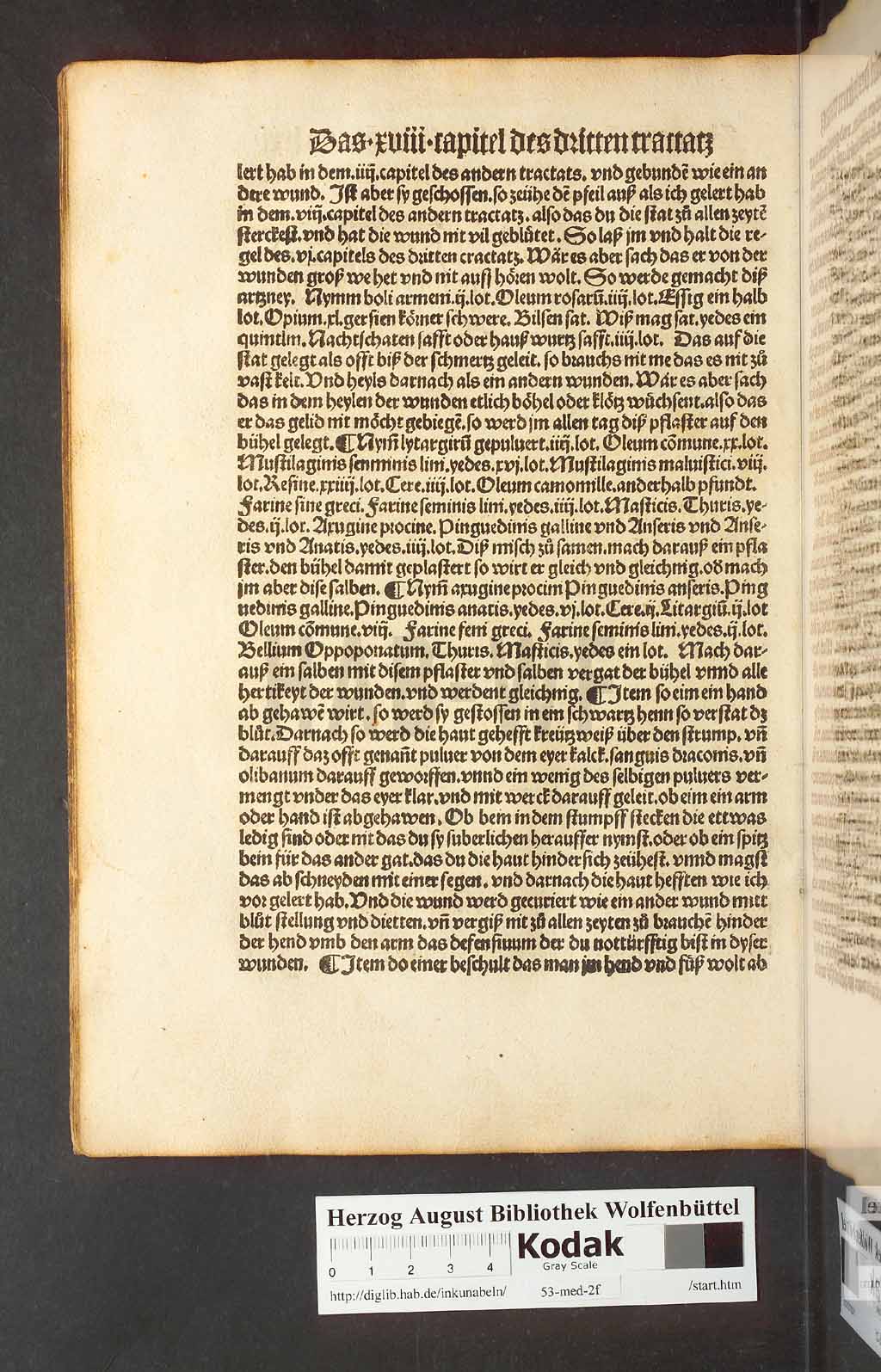 http://diglib.hab.de/inkunabeln/53-med-2f/00140.jpg