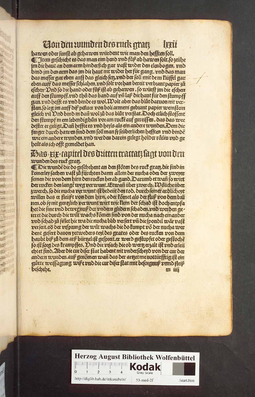 http://diglib.hab.de/inkunabeln/53-med-2f/00141.jpg