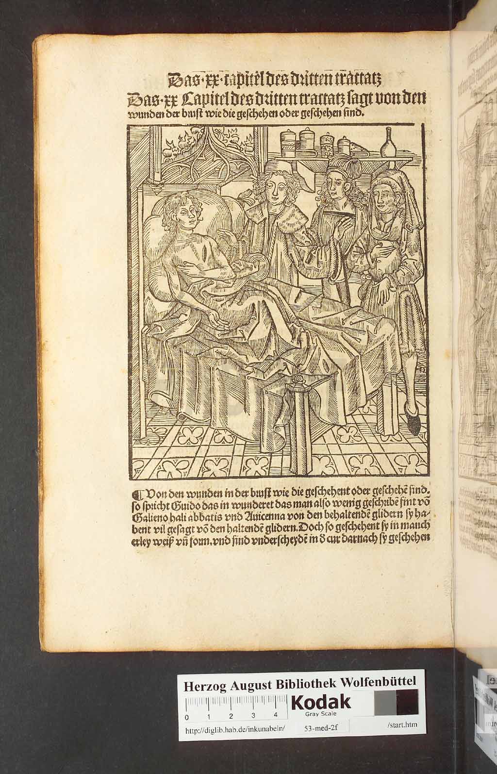 http://diglib.hab.de/inkunabeln/53-med-2f/00142.jpg
