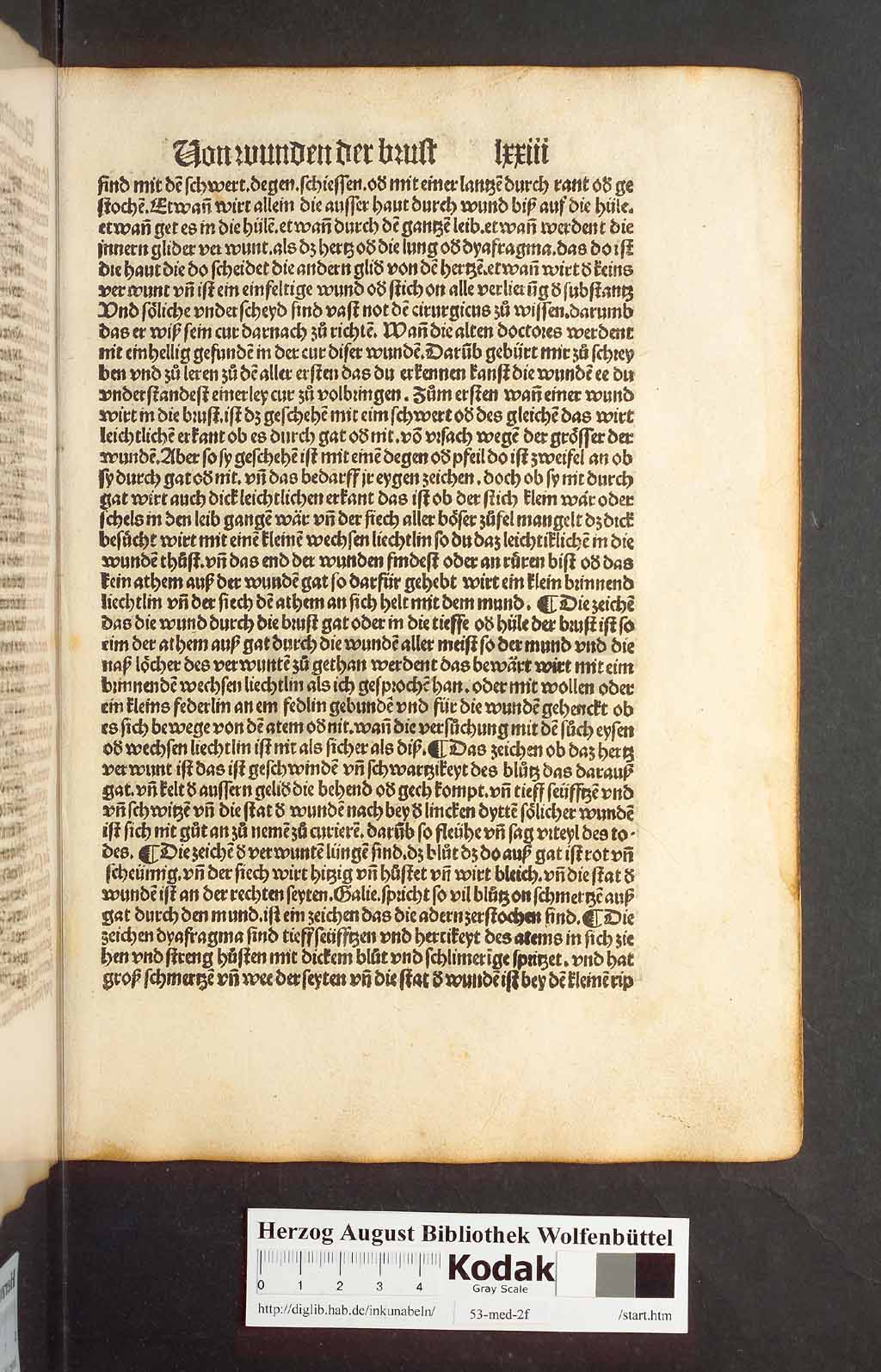 http://diglib.hab.de/inkunabeln/53-med-2f/00143.jpg