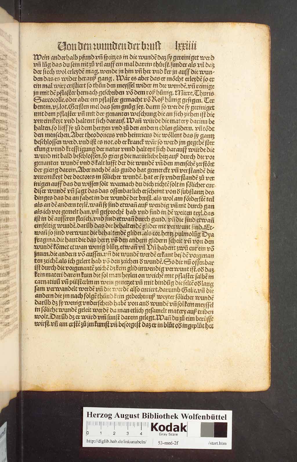 http://diglib.hab.de/inkunabeln/53-med-2f/00145.jpg