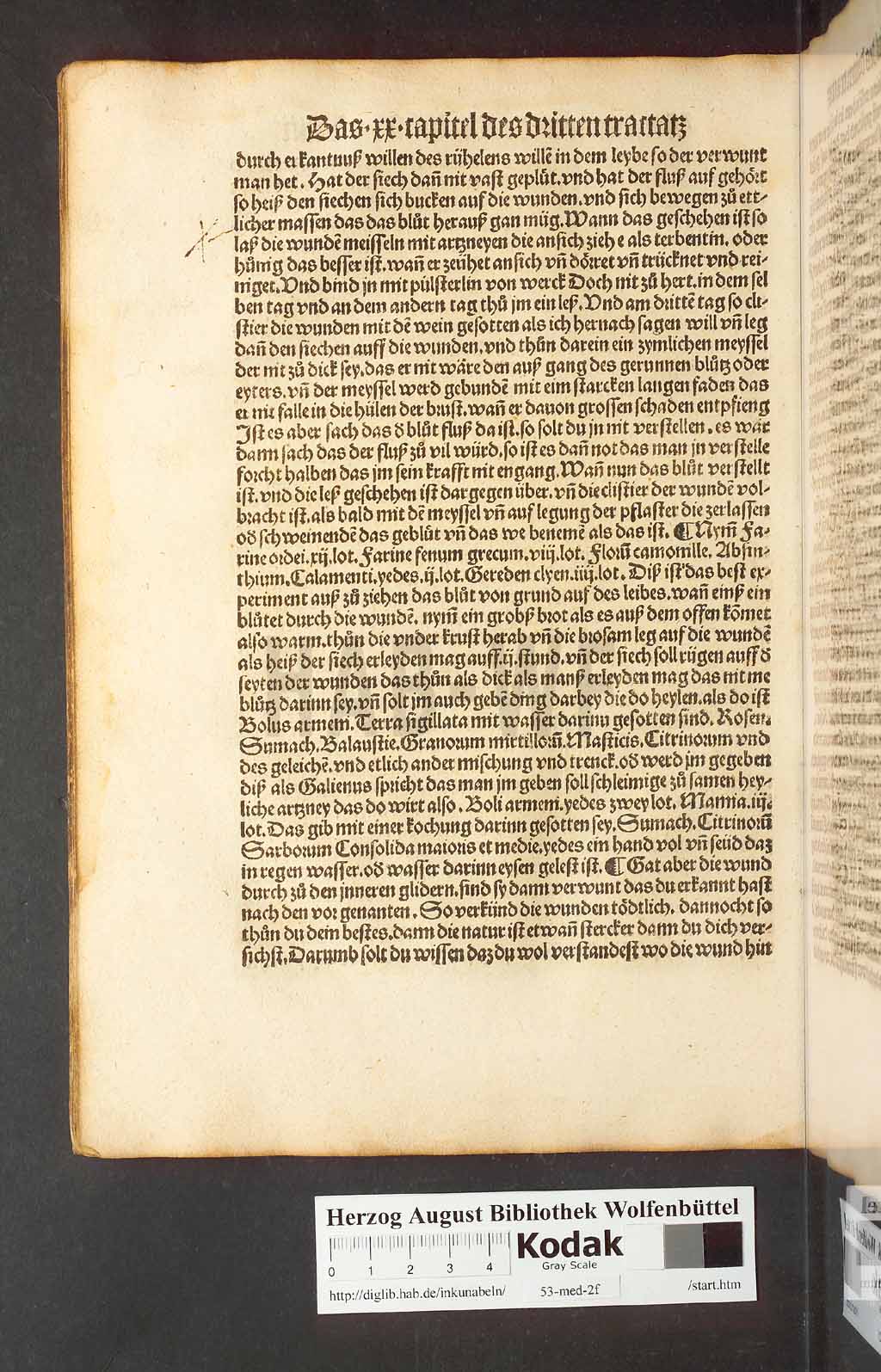 http://diglib.hab.de/inkunabeln/53-med-2f/00146.jpg