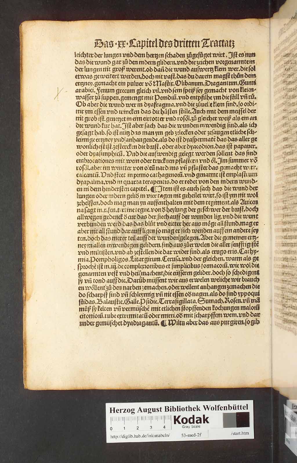 http://diglib.hab.de/inkunabeln/53-med-2f/00148.jpg