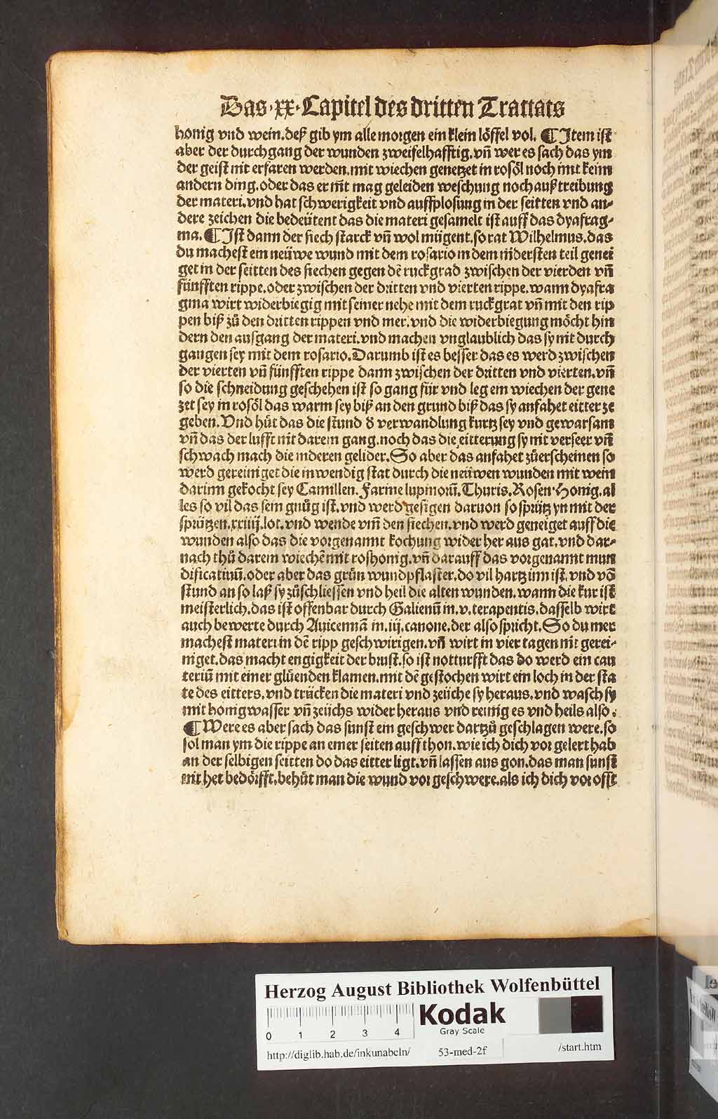http://diglib.hab.de/inkunabeln/53-med-2f/00150.jpg