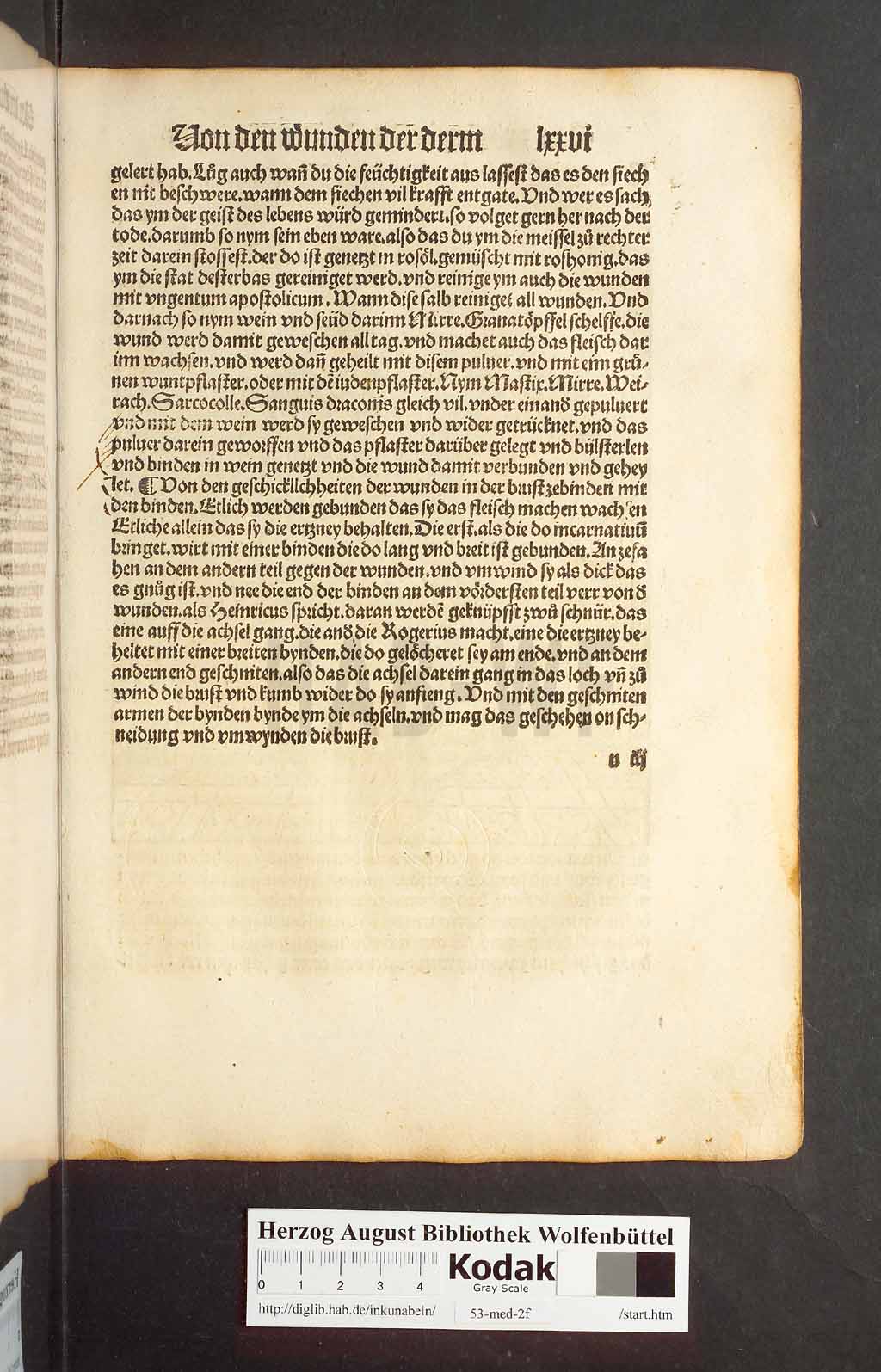 http://diglib.hab.de/inkunabeln/53-med-2f/00151.jpg