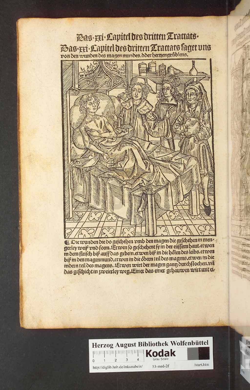 http://diglib.hab.de/inkunabeln/53-med-2f/00152.jpg
