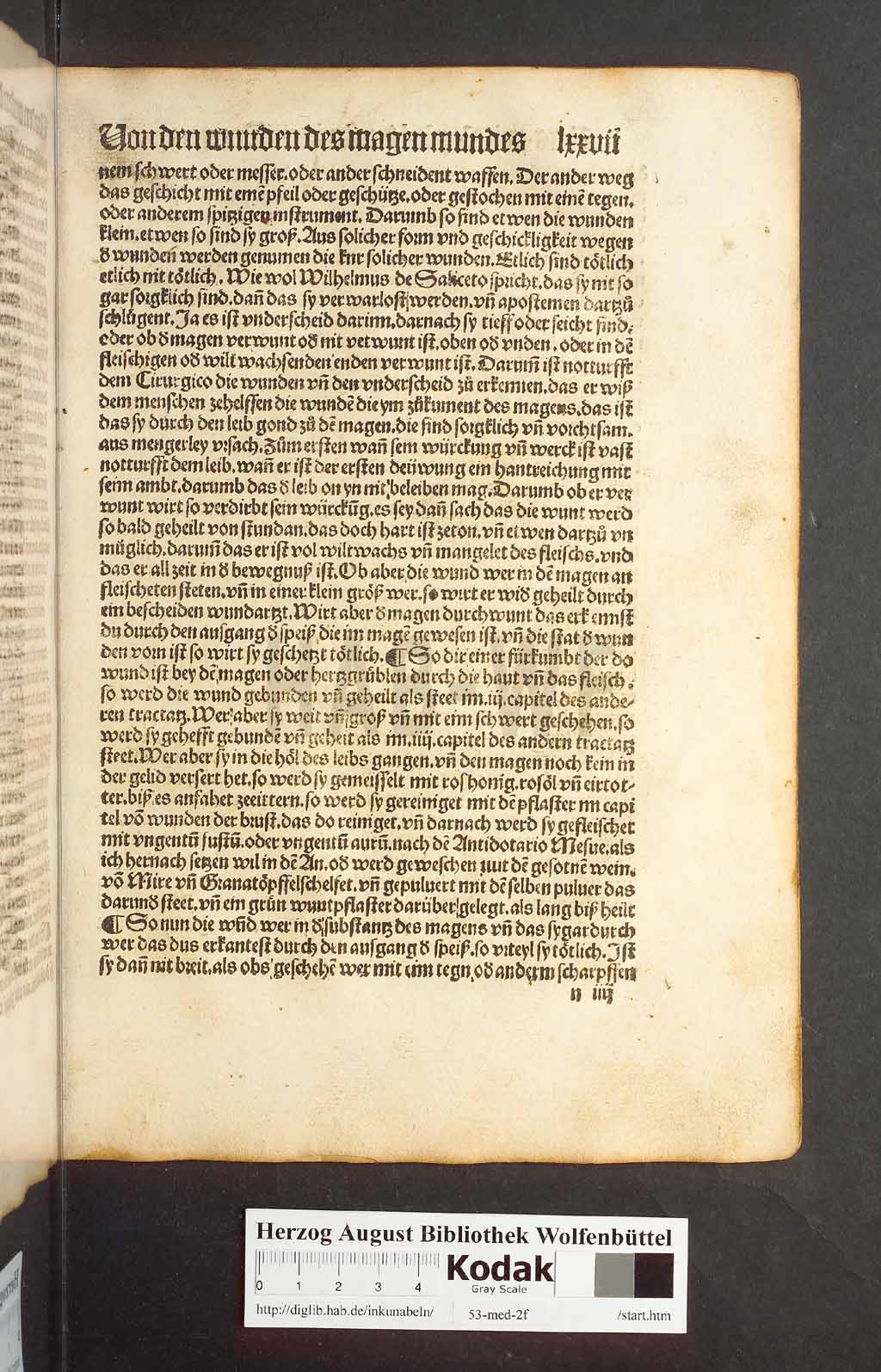 http://diglib.hab.de/inkunabeln/53-med-2f/00153.jpg