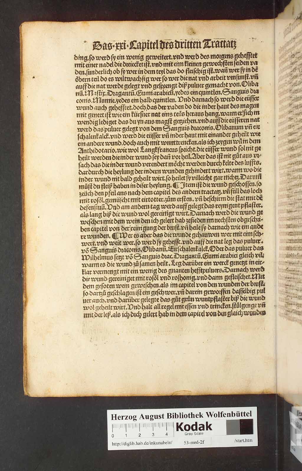 http://diglib.hab.de/inkunabeln/53-med-2f/00154.jpg
