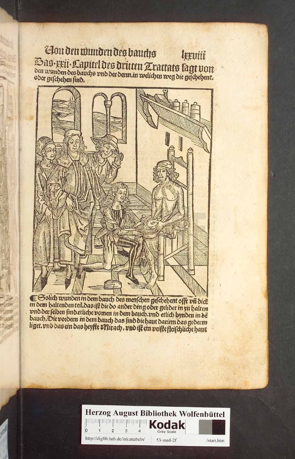 http://diglib.hab.de/inkunabeln/53-med-2f/00155.jpg