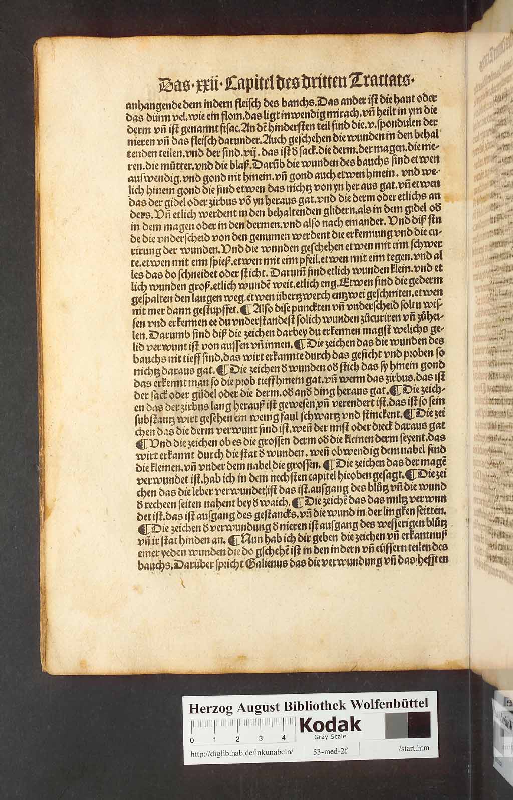http://diglib.hab.de/inkunabeln/53-med-2f/00156.jpg