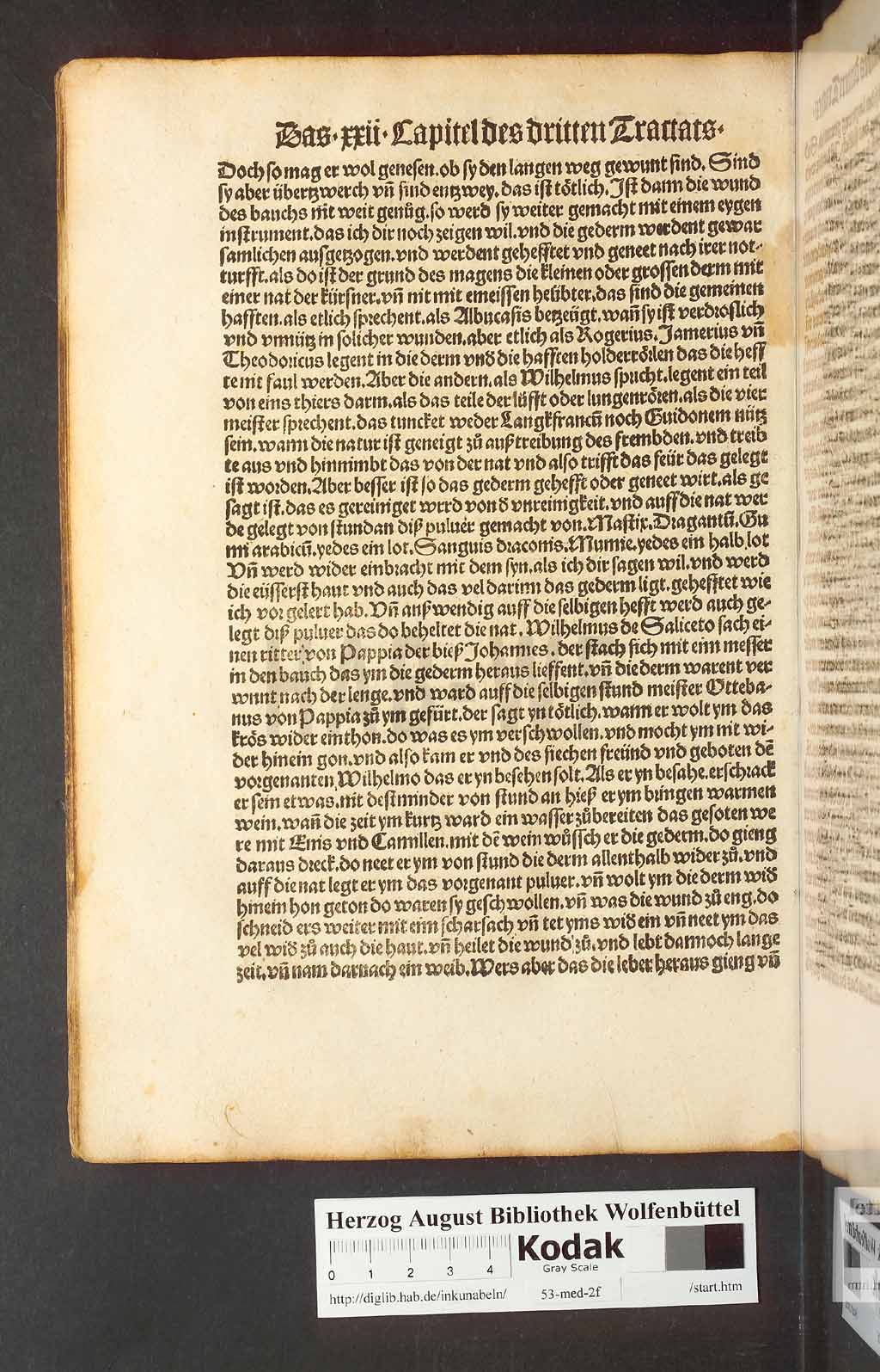 http://diglib.hab.de/inkunabeln/53-med-2f/00158.jpg