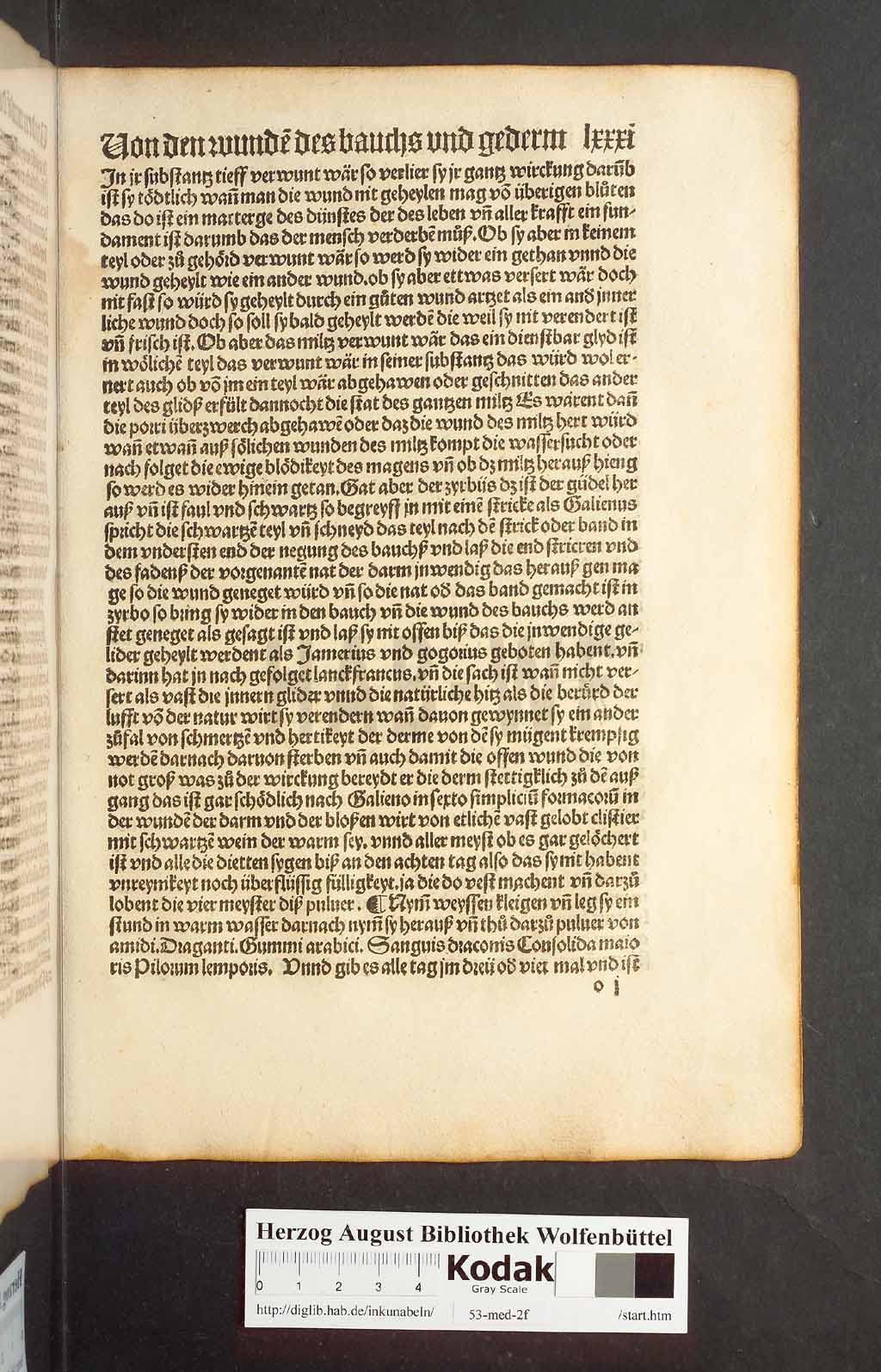 http://diglib.hab.de/inkunabeln/53-med-2f/00159.jpg