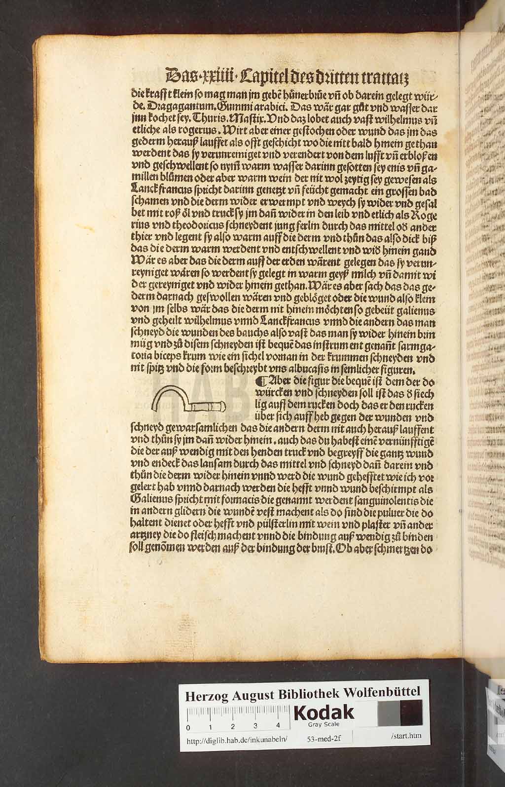http://diglib.hab.de/inkunabeln/53-med-2f/00160.jpg