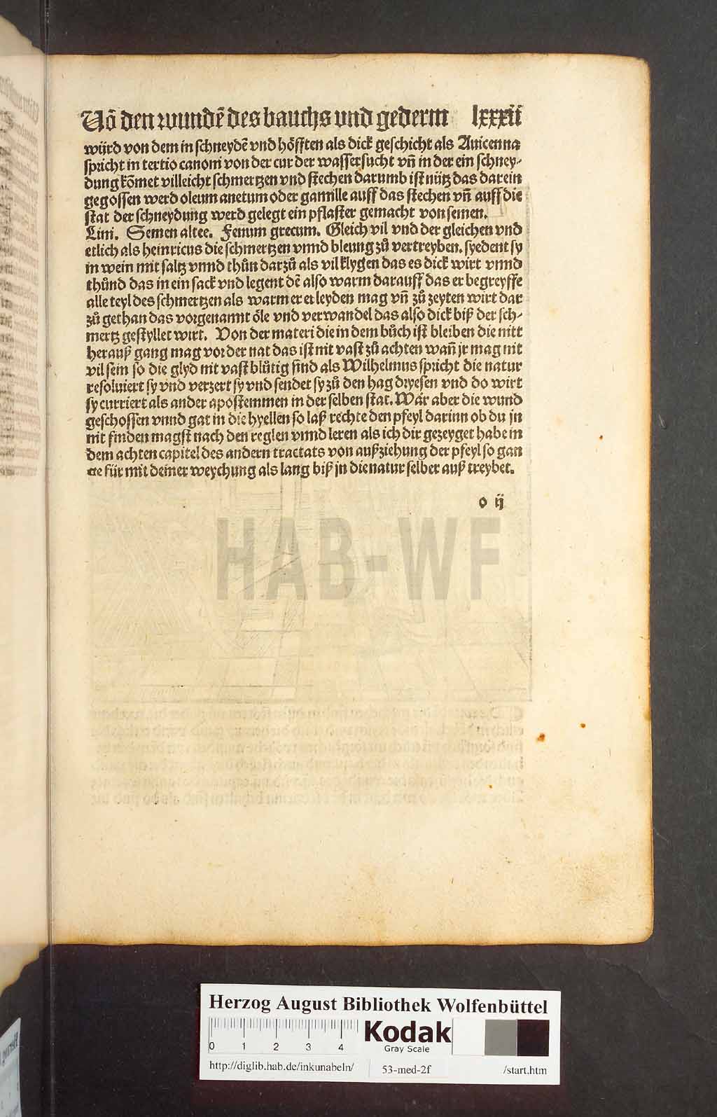 http://diglib.hab.de/inkunabeln/53-med-2f/00161.jpg