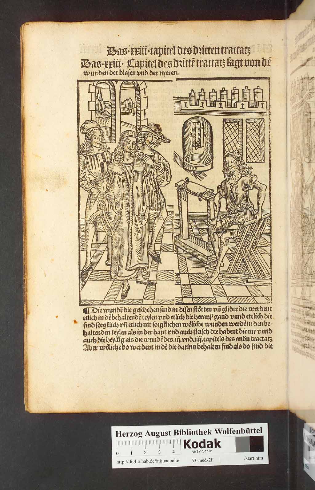 http://diglib.hab.de/inkunabeln/53-med-2f/00162.jpg