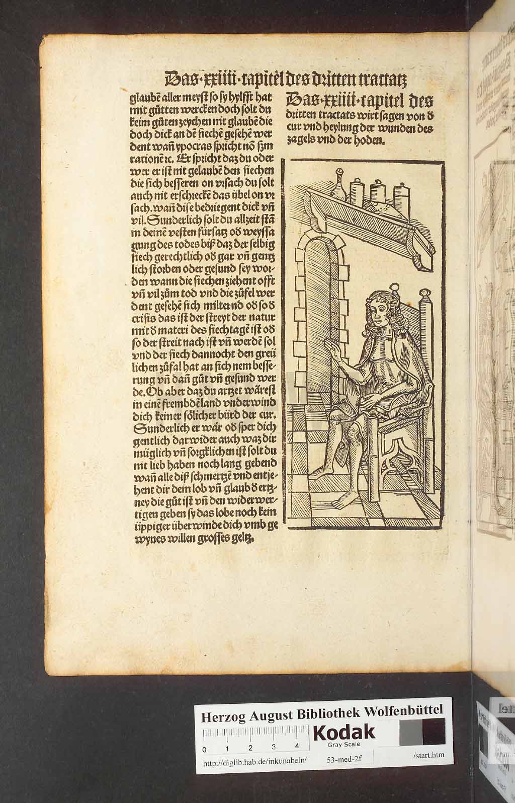 http://diglib.hab.de/inkunabeln/53-med-2f/00164.jpg