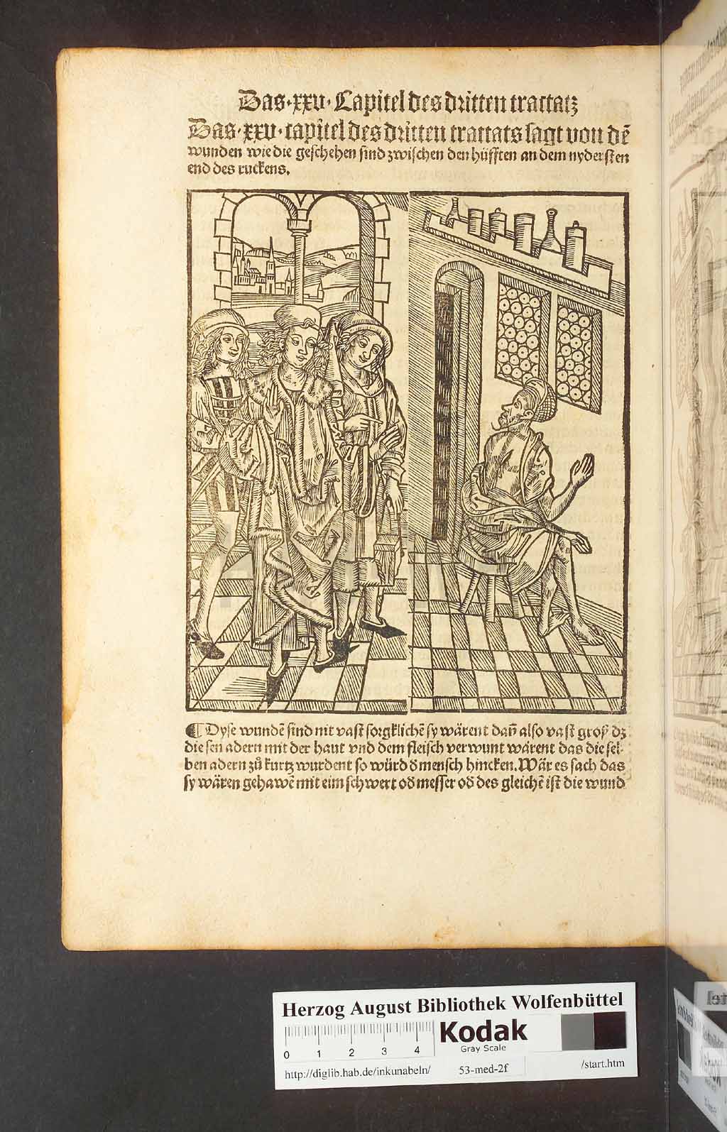 http://diglib.hab.de/inkunabeln/53-med-2f/00166.jpg