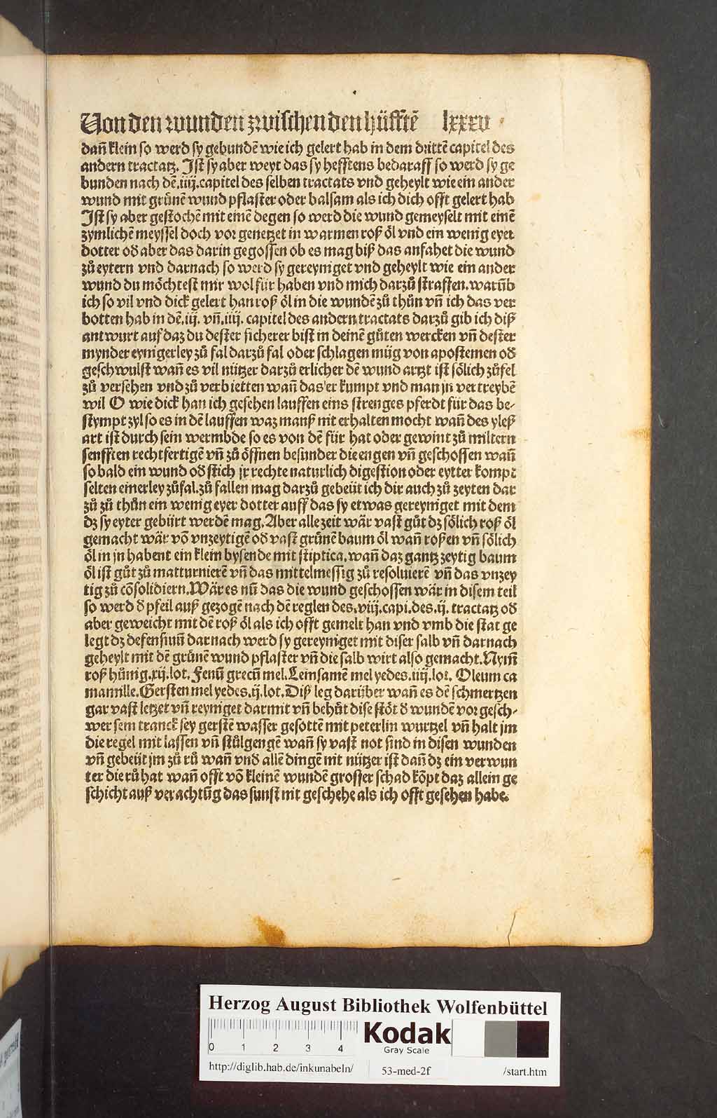 http://diglib.hab.de/inkunabeln/53-med-2f/00167.jpg