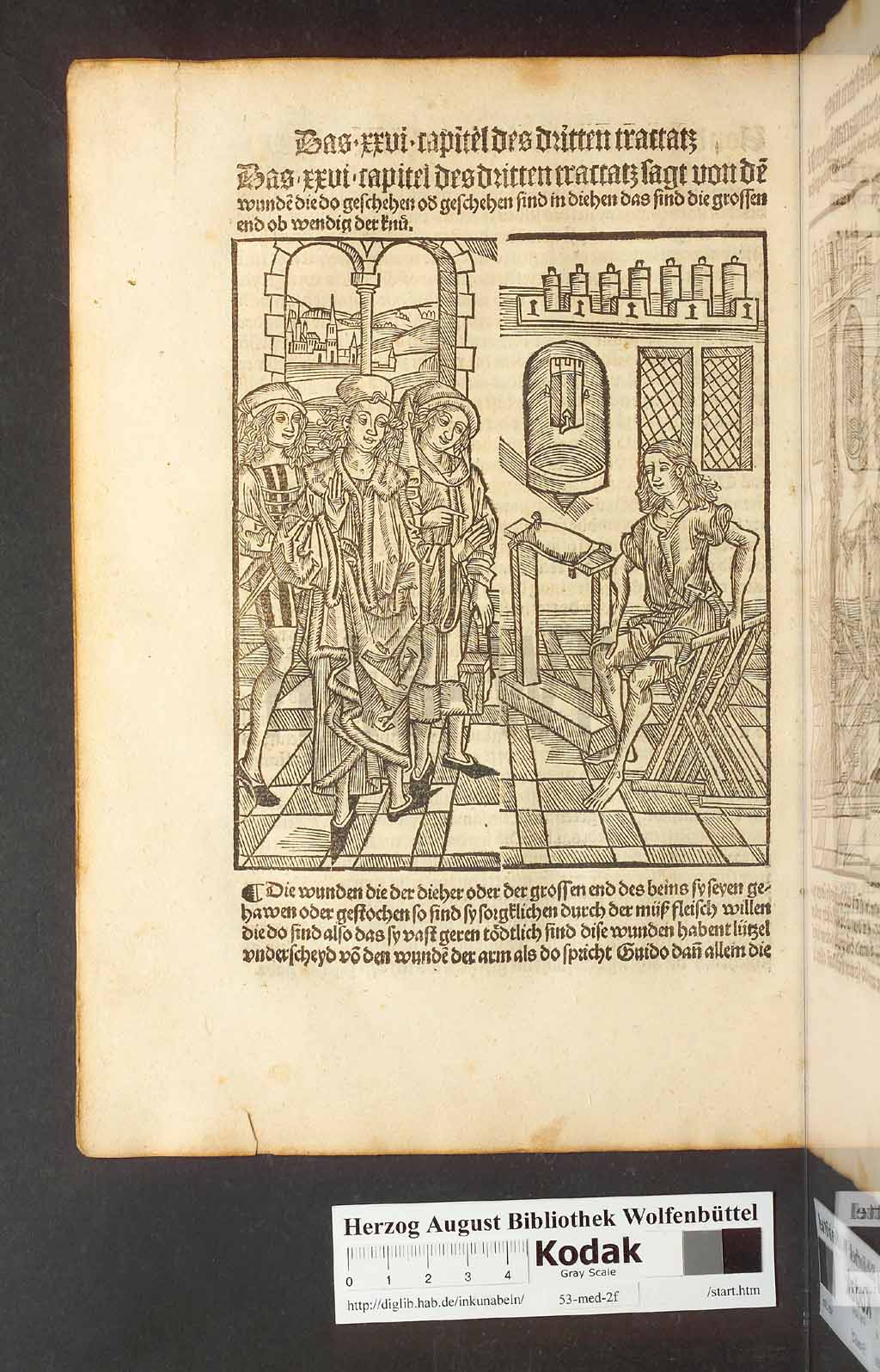 http://diglib.hab.de/inkunabeln/53-med-2f/00168.jpg