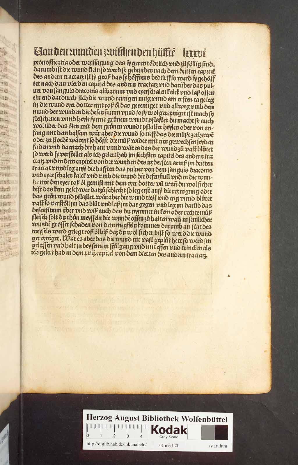 http://diglib.hab.de/inkunabeln/53-med-2f/00169.jpg
